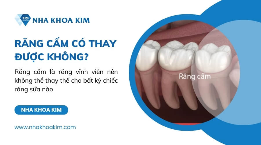 Răng cấm có thay không?