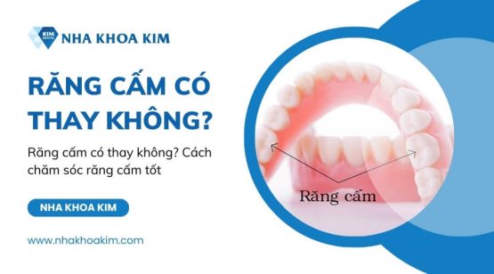 Răng cấm có thay không? Cách chăm sóc răng cấm tốt