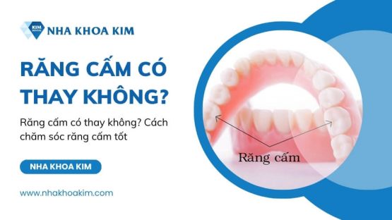Răng cấm có thay không? Cách chăm sóc răng cấm tốt