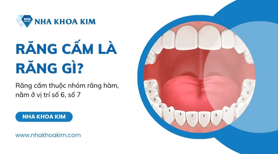Răng cấm là răng gì?