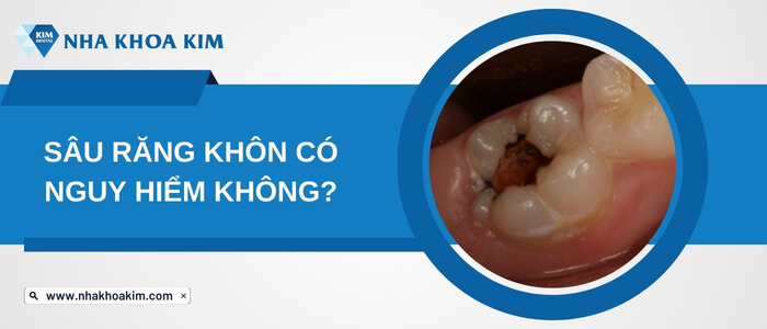 Sâu răng khôn có nguy hiểm không?