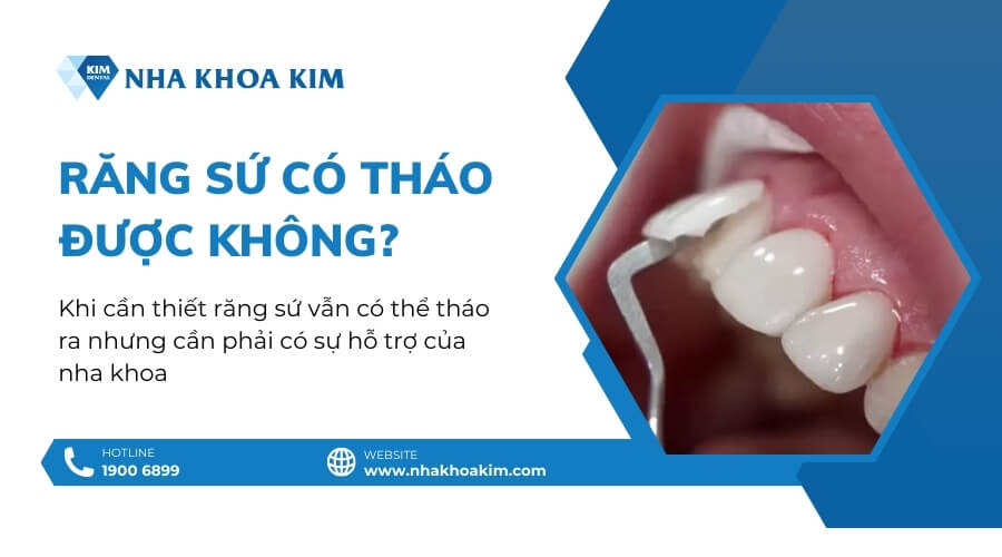 Răng sứ có tháo được không?