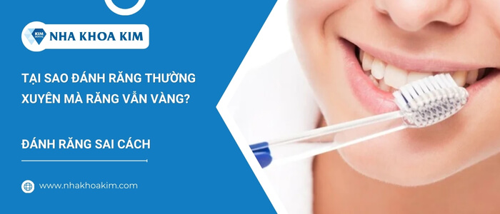 Răng vàng do vệ sinh răng miệng sai cách