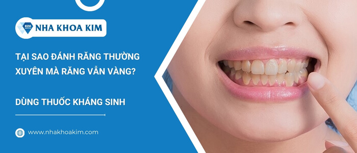 Răng vàng do sử dụng thuốc kháng sinh