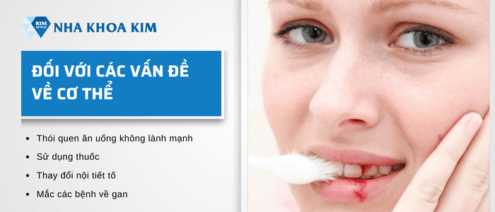 Nguyên nhân đánh răng hay bị chảy máu