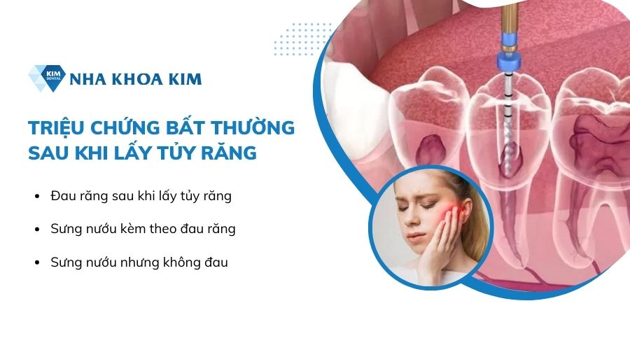 Triệu chứng bất thường sau khi lấy tủy răng