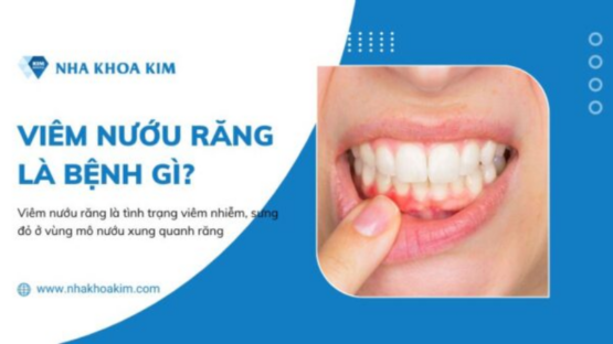 Hình ảnh viêm nướu răng giúp sớm nhận biết và điều trị