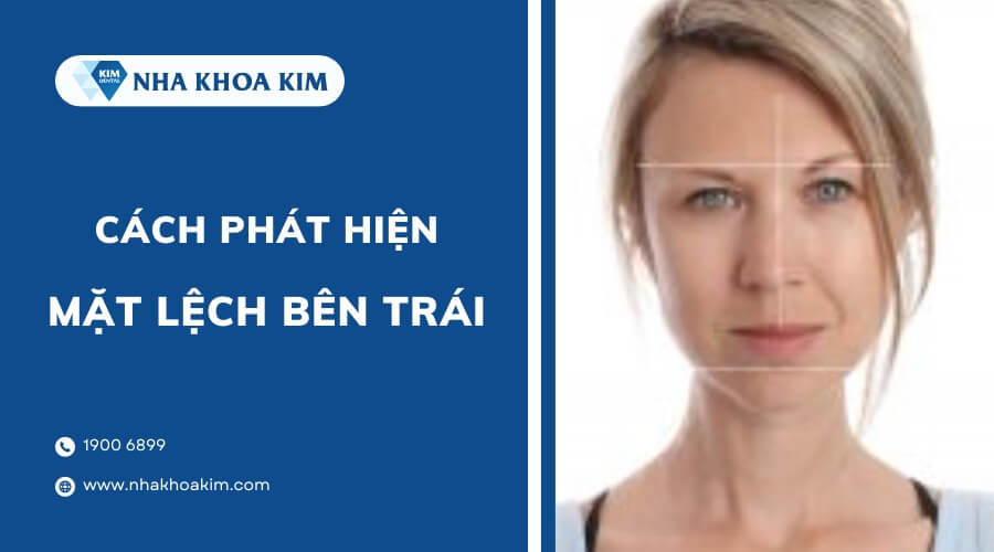 Làm sao biết mặt bị lệch bên trái?