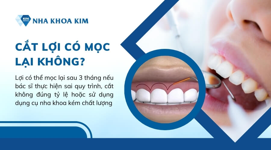 Cắt lợi có mọc lại không?