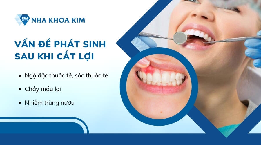 Cắt lợi có ảnh hưởng gì không?