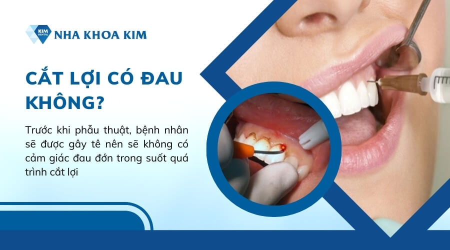 Cắt lợi có đau không?