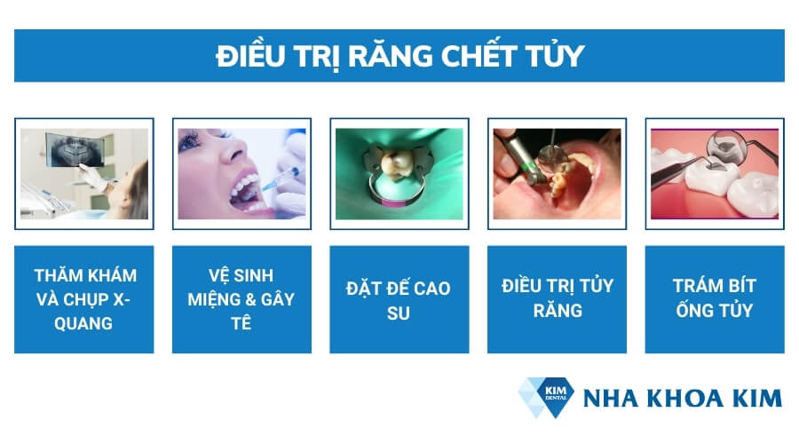 Cách điều trị răng chết tủy