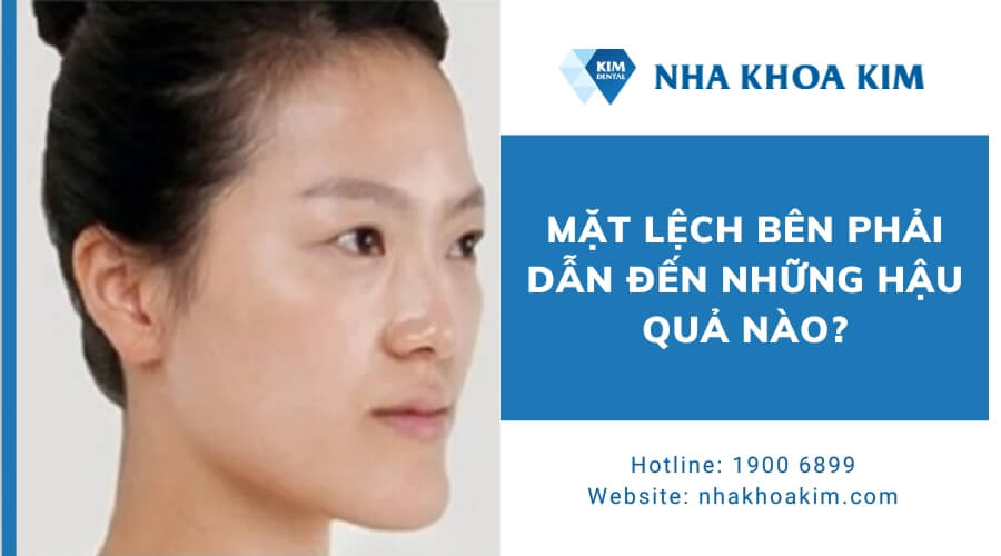 Mặt lệch bên phải có nguy hiểm không?