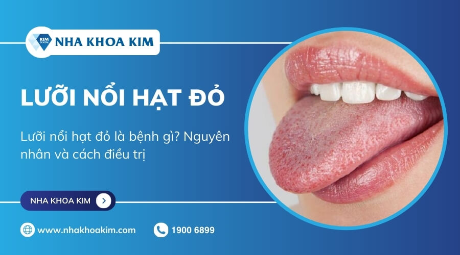 Điều trị lưỡi trắng nổi hạt đỏ