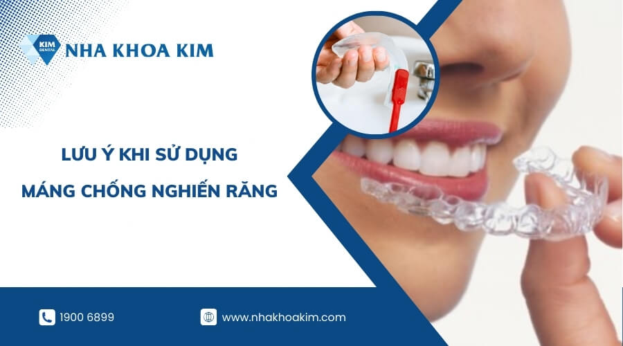 Lưu ý khi sử dụng máng chống nghiến răng