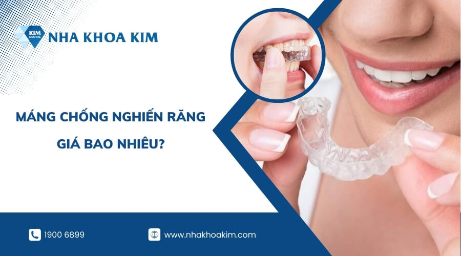 Miếng chống nghiến răng giá bao nhiêu?