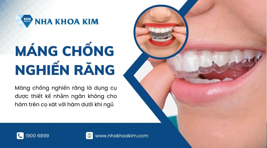 Máng chống nghiến răng là gì?