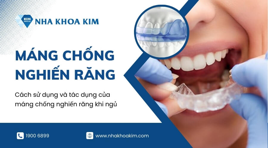 Cách sử dụng và tác dụng của máng chống nghiến răng khi ngủ
