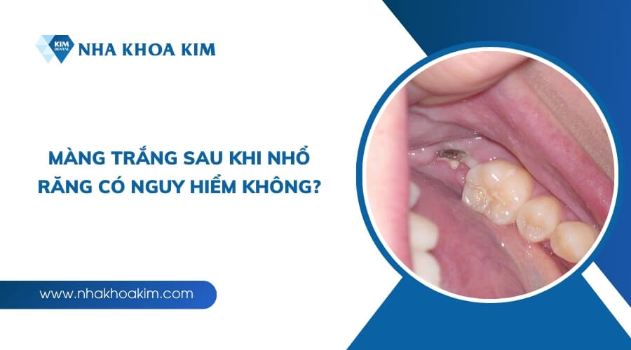 Màng trắng sau khi nhổ răng có nguy hiểm không?