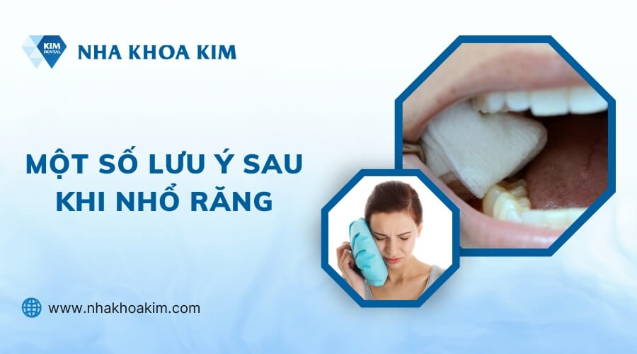 Những lưu ý sau khi nhổ răng 