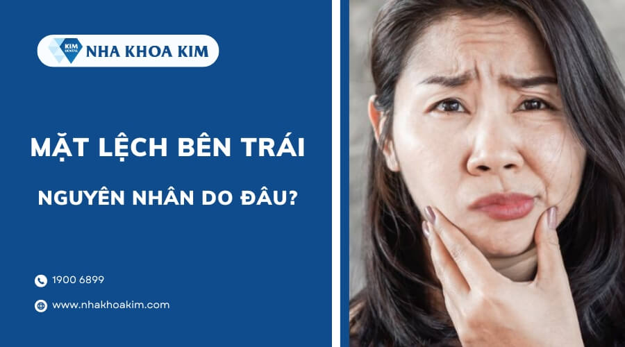 Nguyên nhân làm mặt lệch bên trái