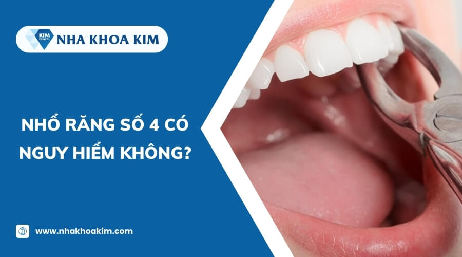 Nhổ răng số 4 có nguy hiểm không?