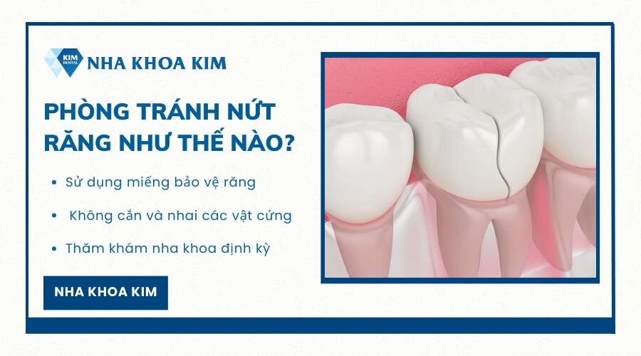 Phòng tránh nứt răng như thế nào?