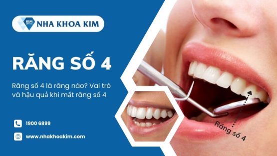 Răng số 4 là răng nào? Vai trò và hậu quả khi mất răng số 4