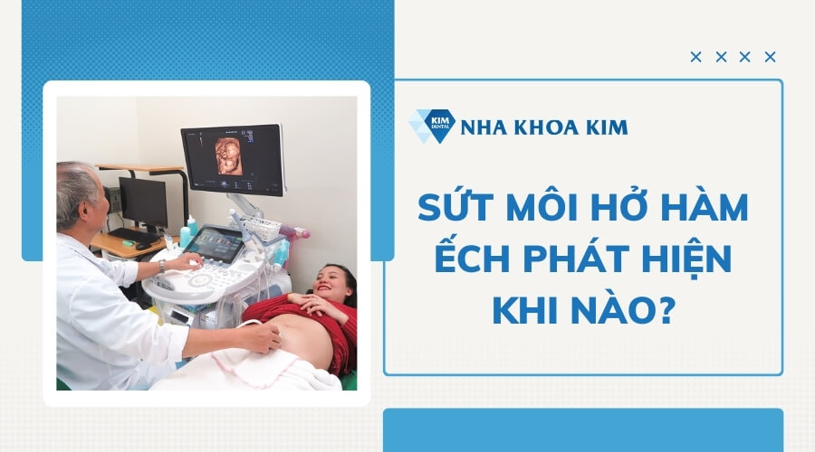 Sứt môi hở hàm ếch phát hiện khi nào?