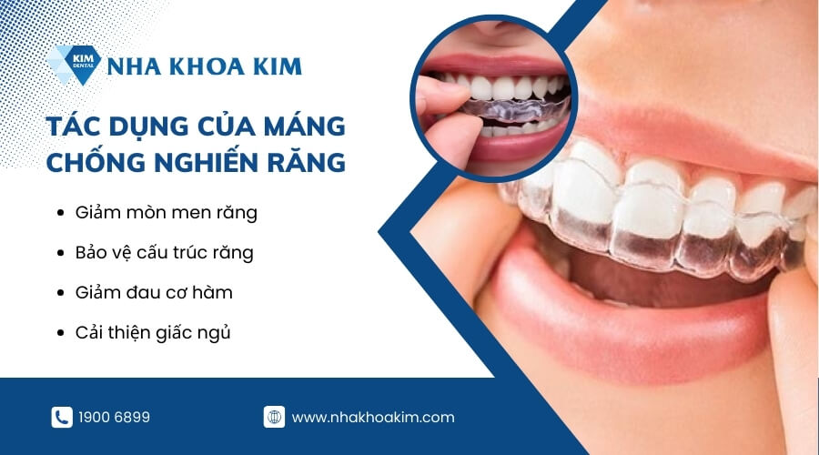 Tác dụng của máng chống nghiến răng