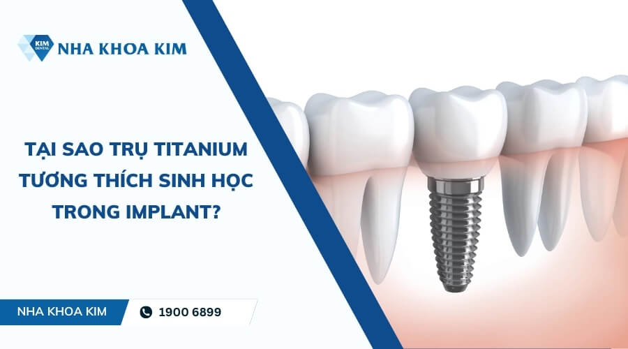 Tại sao Titanium được dùng trong cấy ghép Implant?