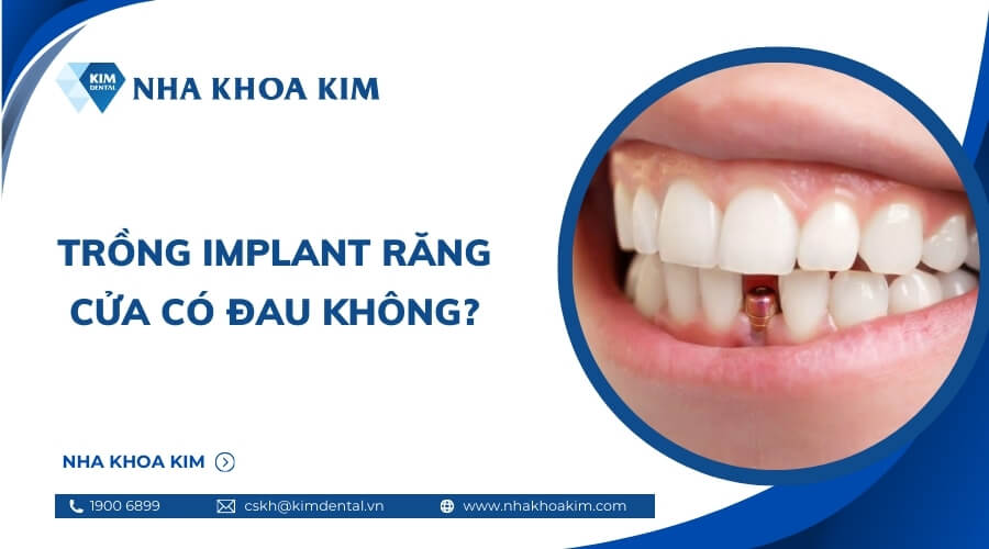 Trồng Implant răng cửa có đau không?