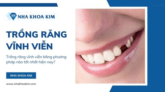 Trồng răng vĩnh viễn bằng phương pháp nào tốt nhất hiện nay?