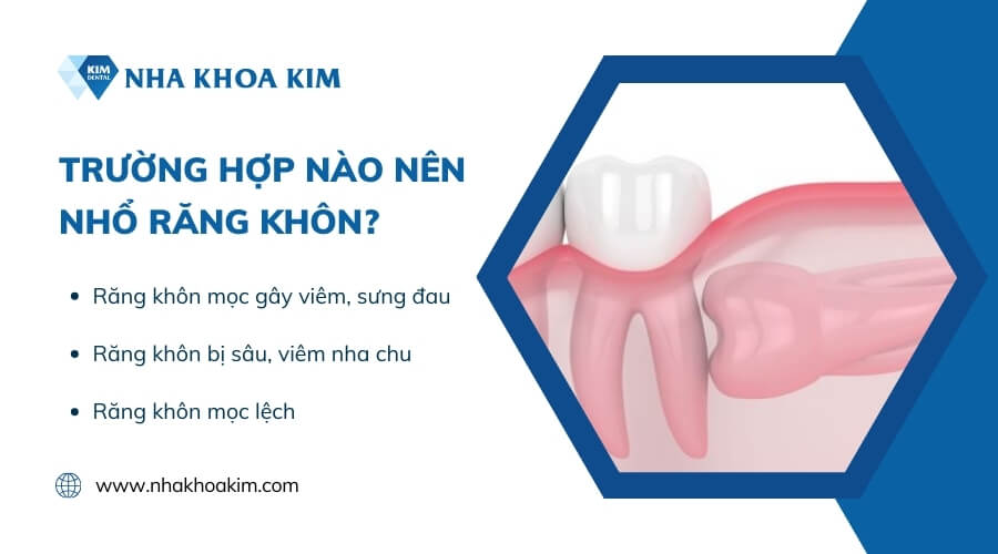 Khi nào nên nhổ răng khôn?