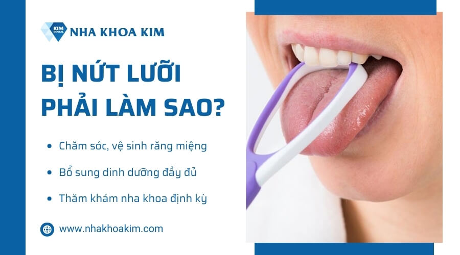 Bị nứt lưỡi phải làm sao?