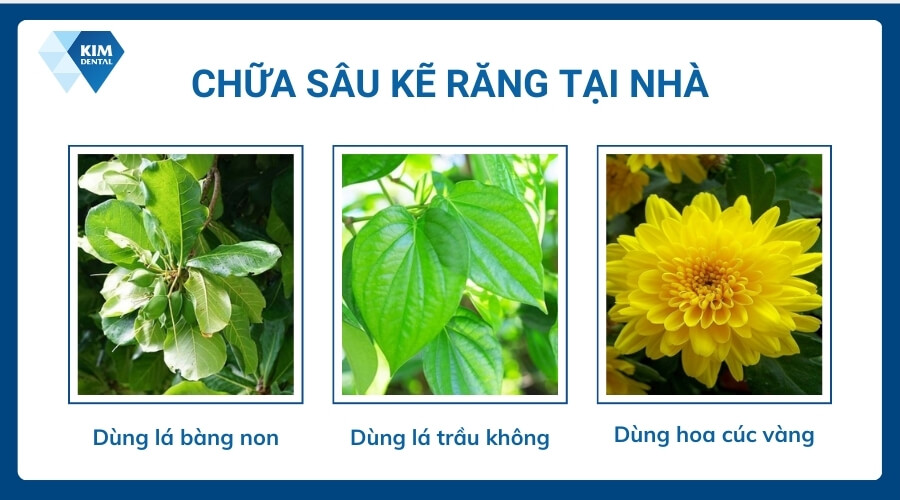 Cách chữa sâu kẽ răng tại nhà