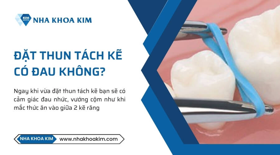 Qúa trình đặt thun tách kẽ có đau không?