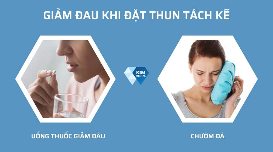 Cách giảm đau khi đặt thun tách kẽ