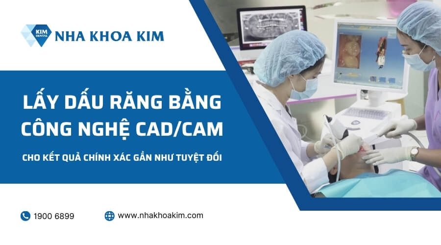 Lấy dấu bằng công nghệ CAD/CAM