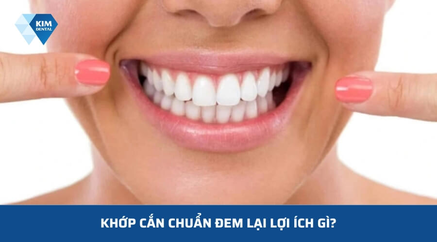 Ưu điểm của hàm răng khớp cắn chuẩn