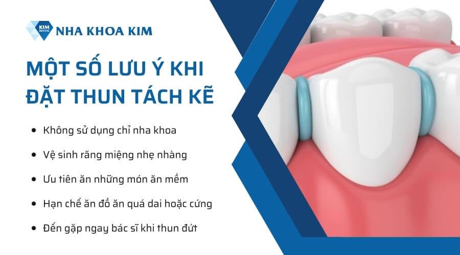 Một số lưu ý sau khi đặt thun tách kẽ