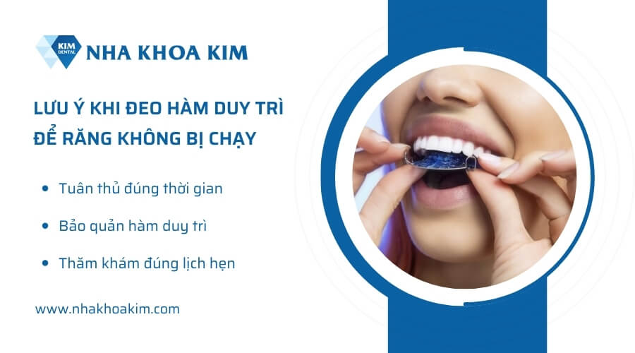 Lưu ý khi đeo hàm duy trì để không bị chạy răng