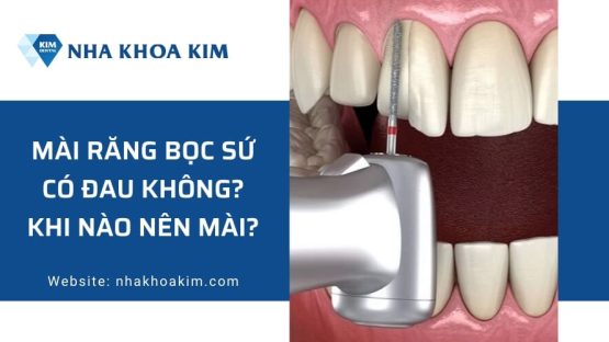 Mài răng bọc sứ có đau không? Khi nào nên mài?