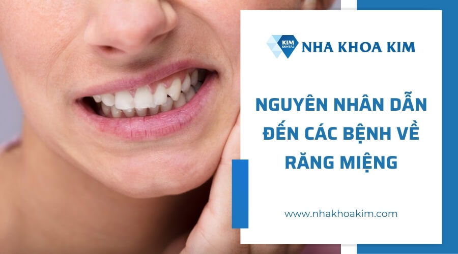 Nguyên nhân gây ra các bệnh về răng miệng