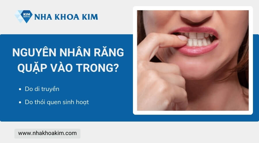 Vì sao răng quặp vào trong?