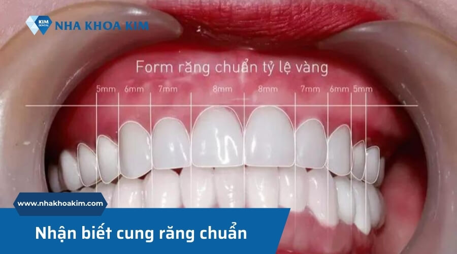 Cách nhận biết cung răng chuẩn, đẹp