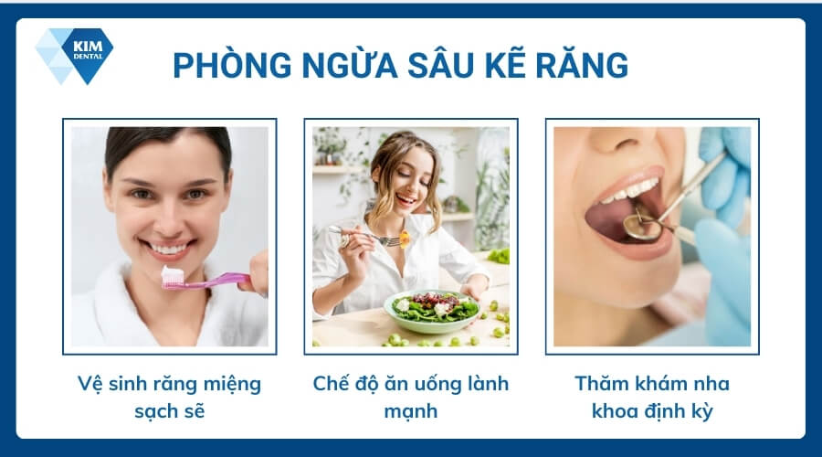 Cách phòng ngừa tình trạng sâu kẽ răng