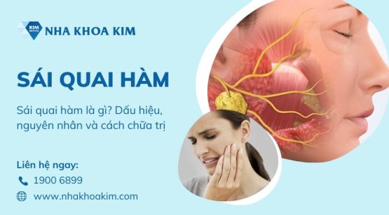 Sái quai hàm là gì? Dấu hiệu, nguyên nhân và cách chữa trị