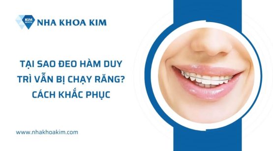 Tại sao đeo hàm duy trì vẫn bị chạy răng? Cách khắc phục