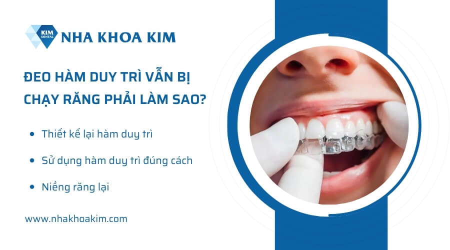 Đeo hàm duy trì vẫn bị chạy răng phải làm sao?